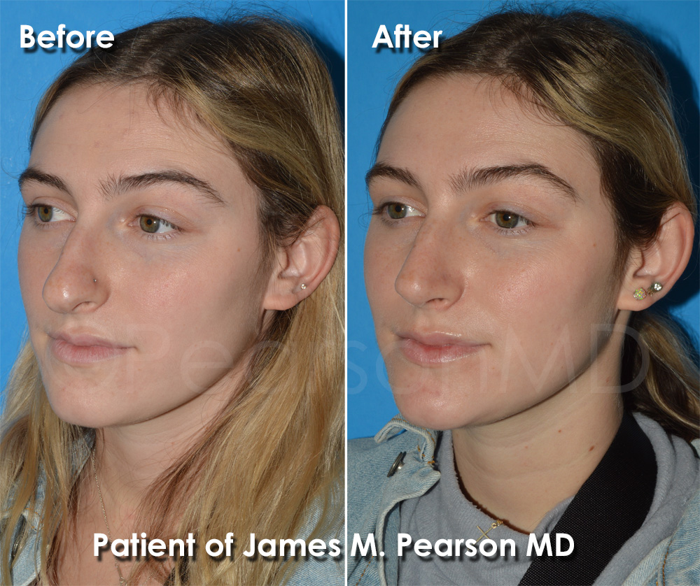 Pearson Cosmetic Surgery