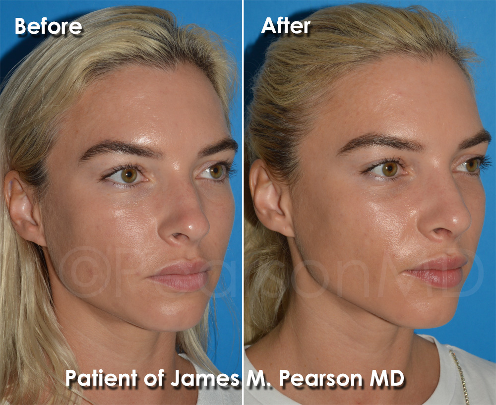 Pearson Plastic Surgery