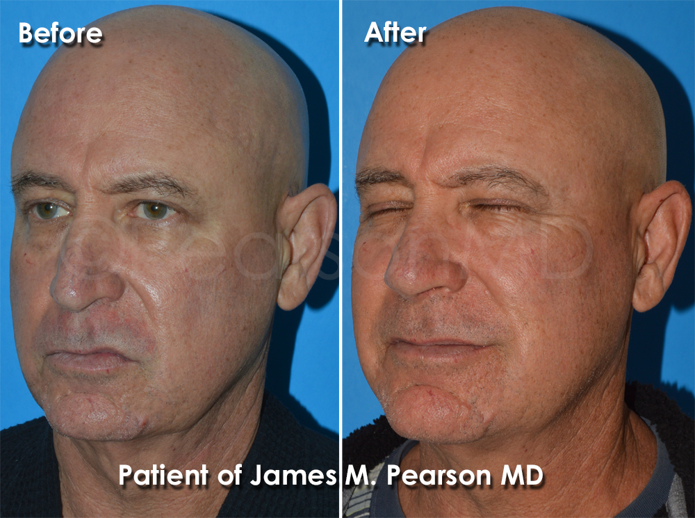 Pearson Cosmetic Surgery