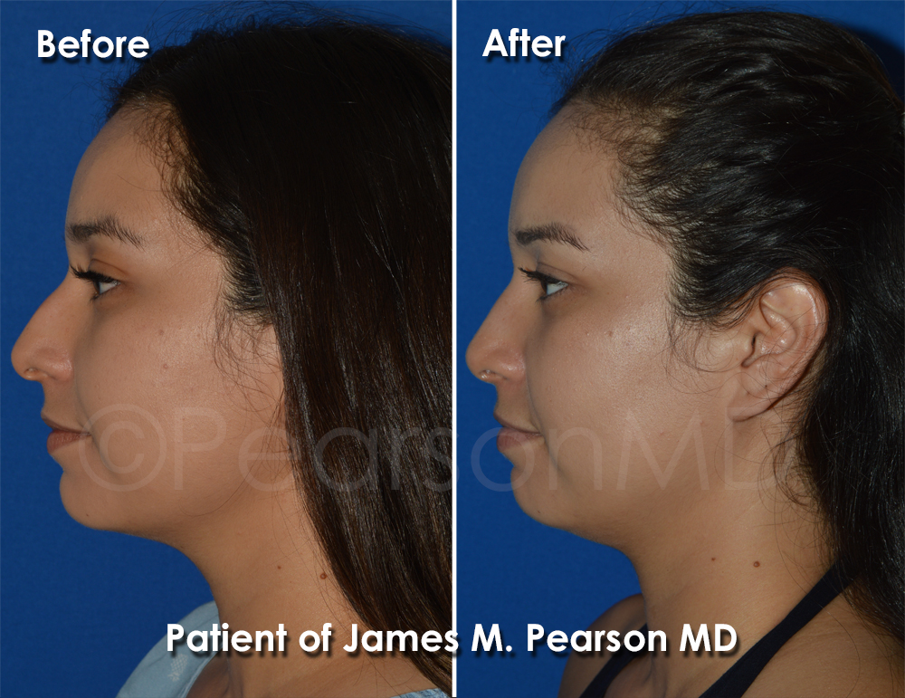 Pearson Plastic Surgery