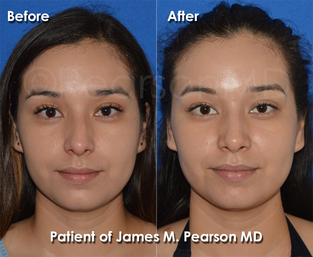 Pearson Cosmetic Surgery