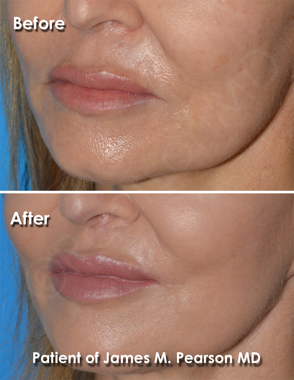 Pearson Plastic Surgery