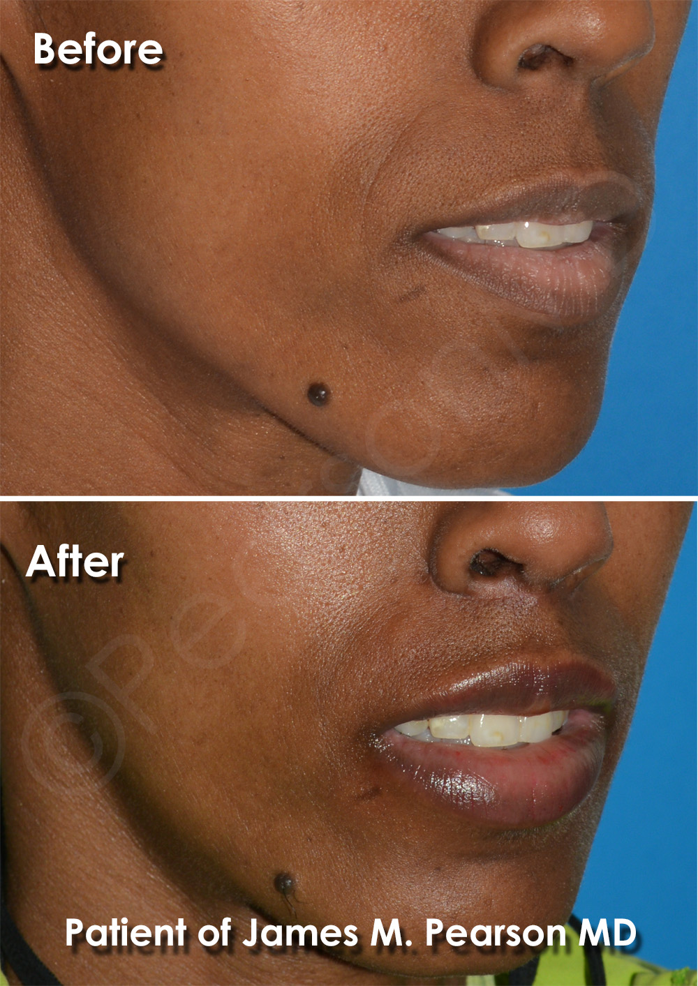 Pearson Cosmetic Surgery