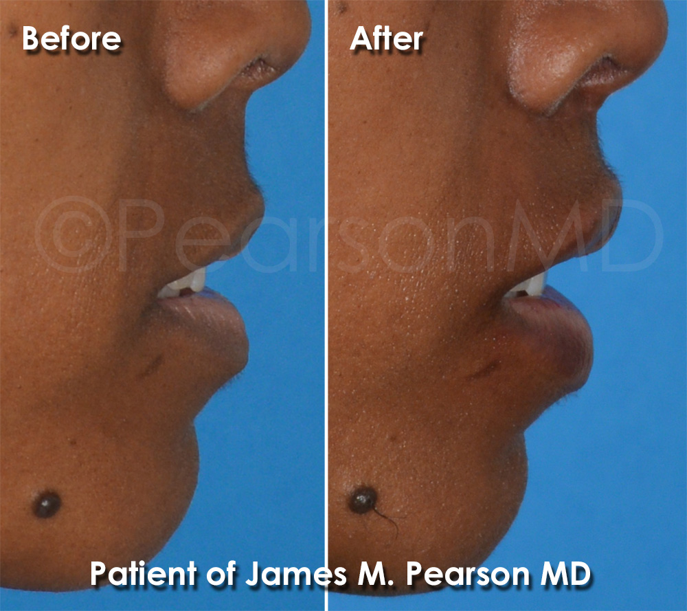 Dr. Pearson Plastic Surgery