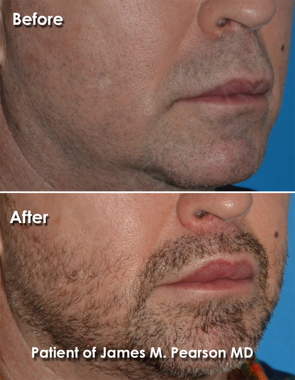 Pearson Cosmetic Surgery