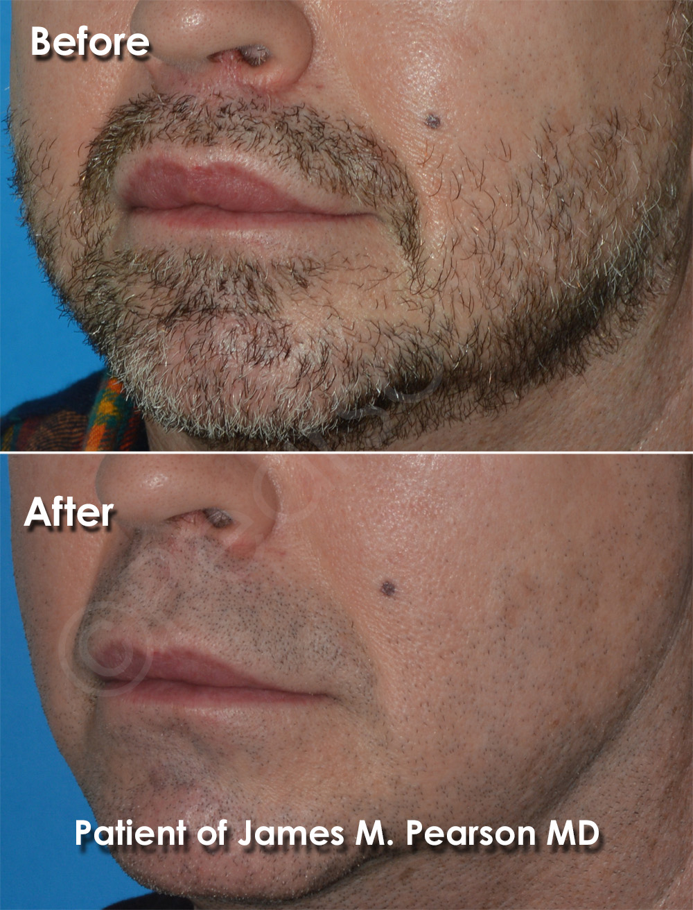 Pearson Plastic Surgery