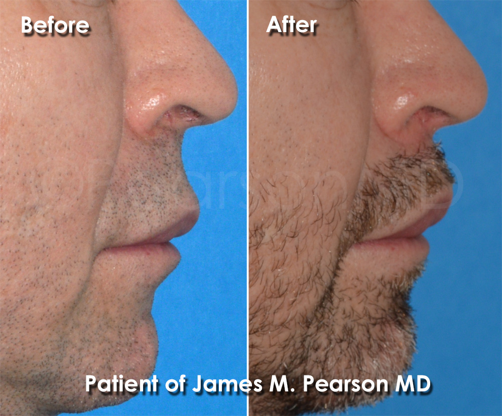 Dr. Pearson Plastic Surgery