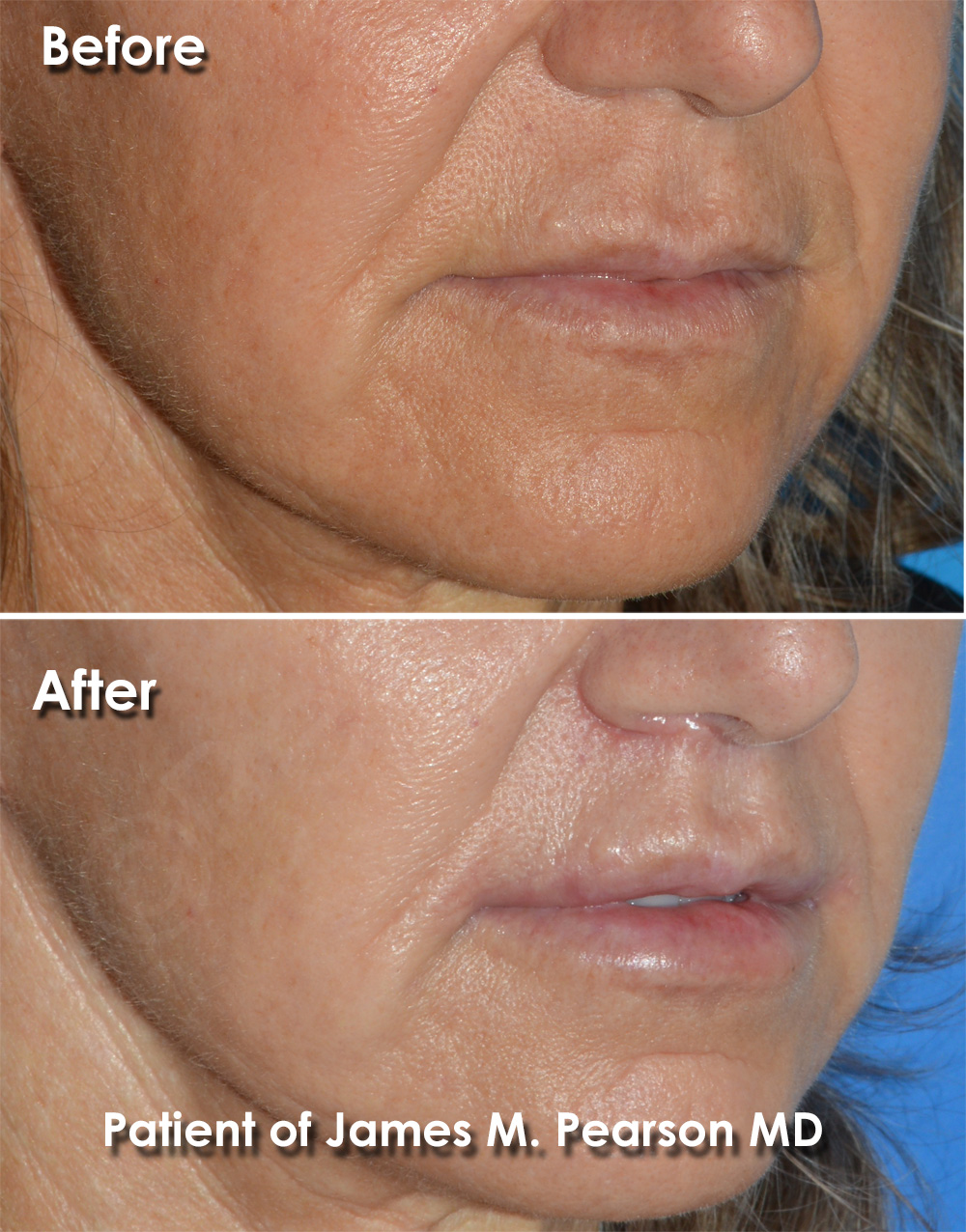 Pearson Cosmetic Surgery