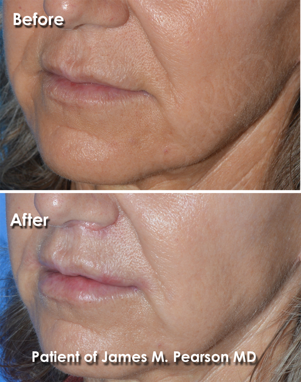 Pearson Plastic Surgery