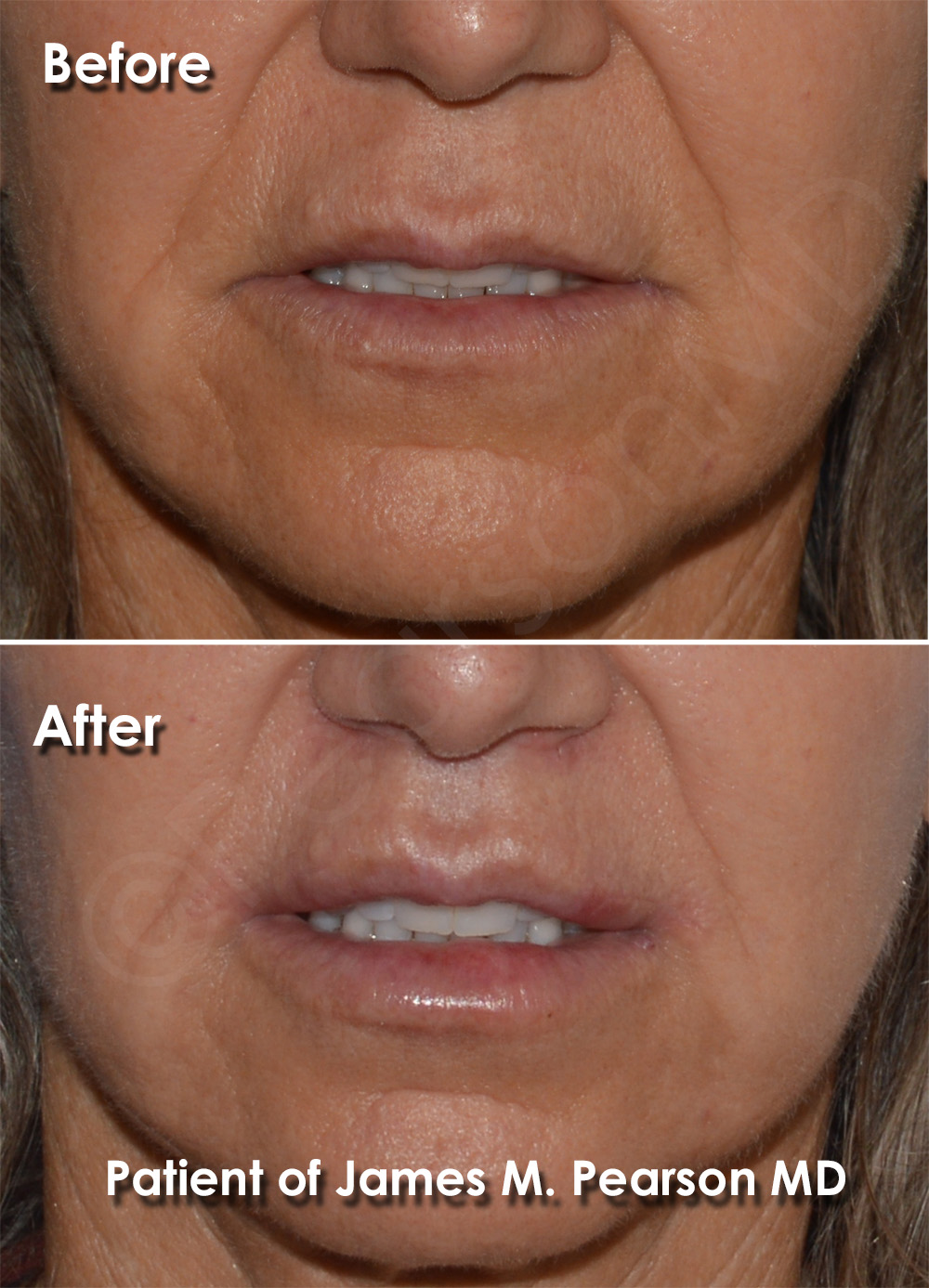 Dr. Pearson Plastic Surgery