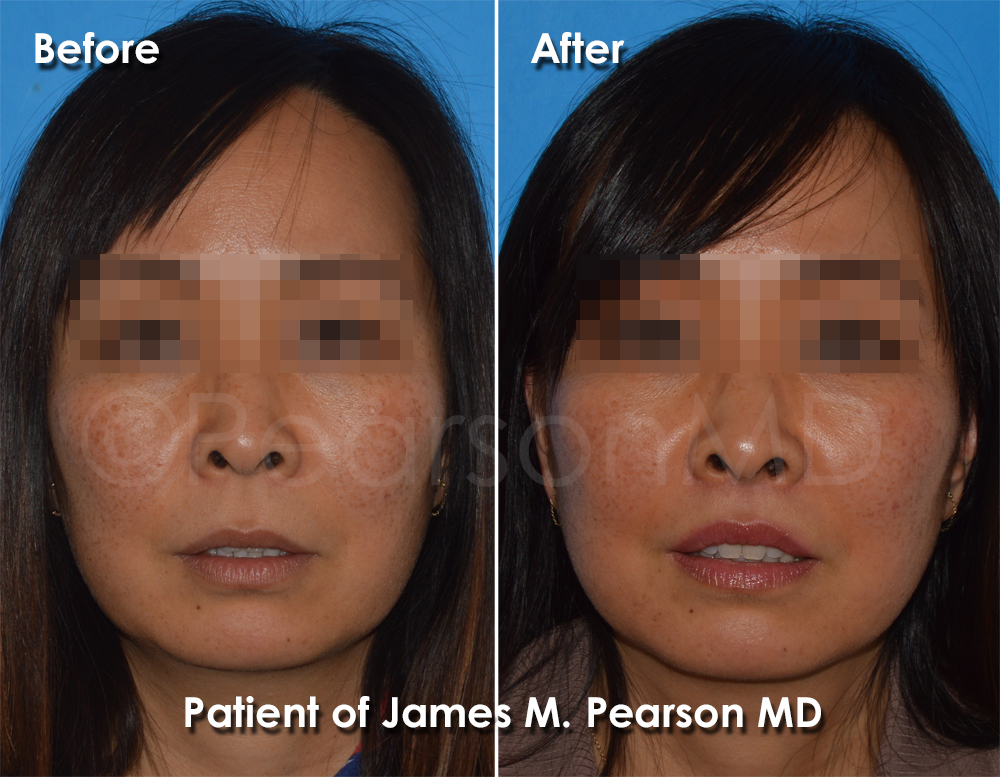 Dr. Pearson Plastic Surgeon