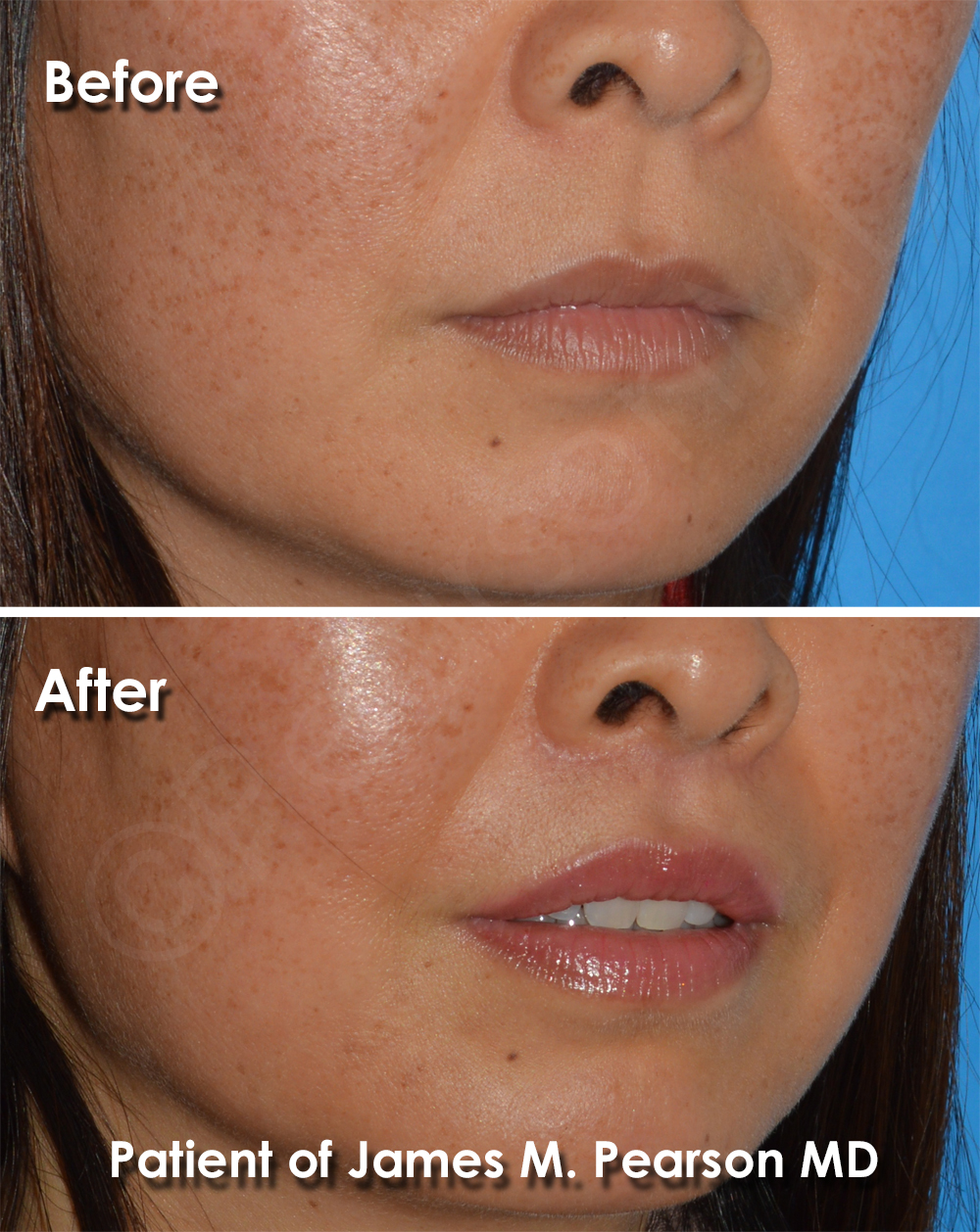 Pearson Plastic Surgery