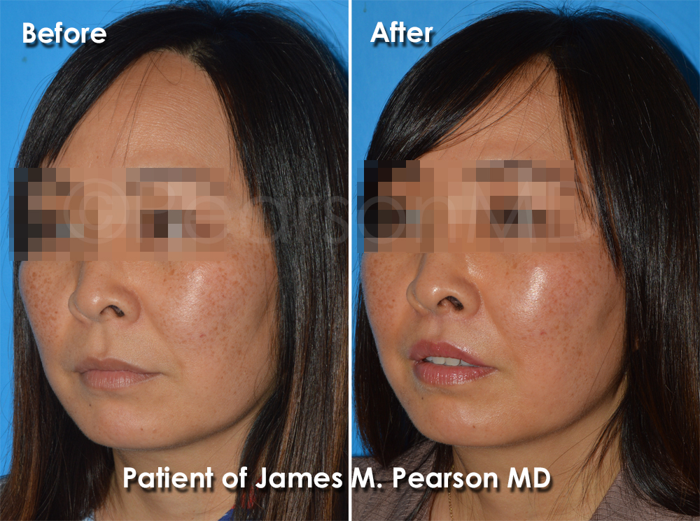 Dr. Pearson Plastic Surgery