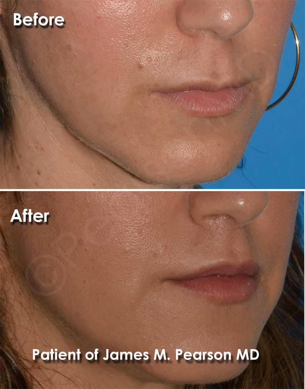 Dr. Pearson Plastic Surgeon