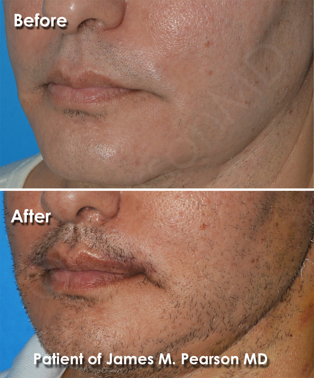 Pearson Plastic Surgery