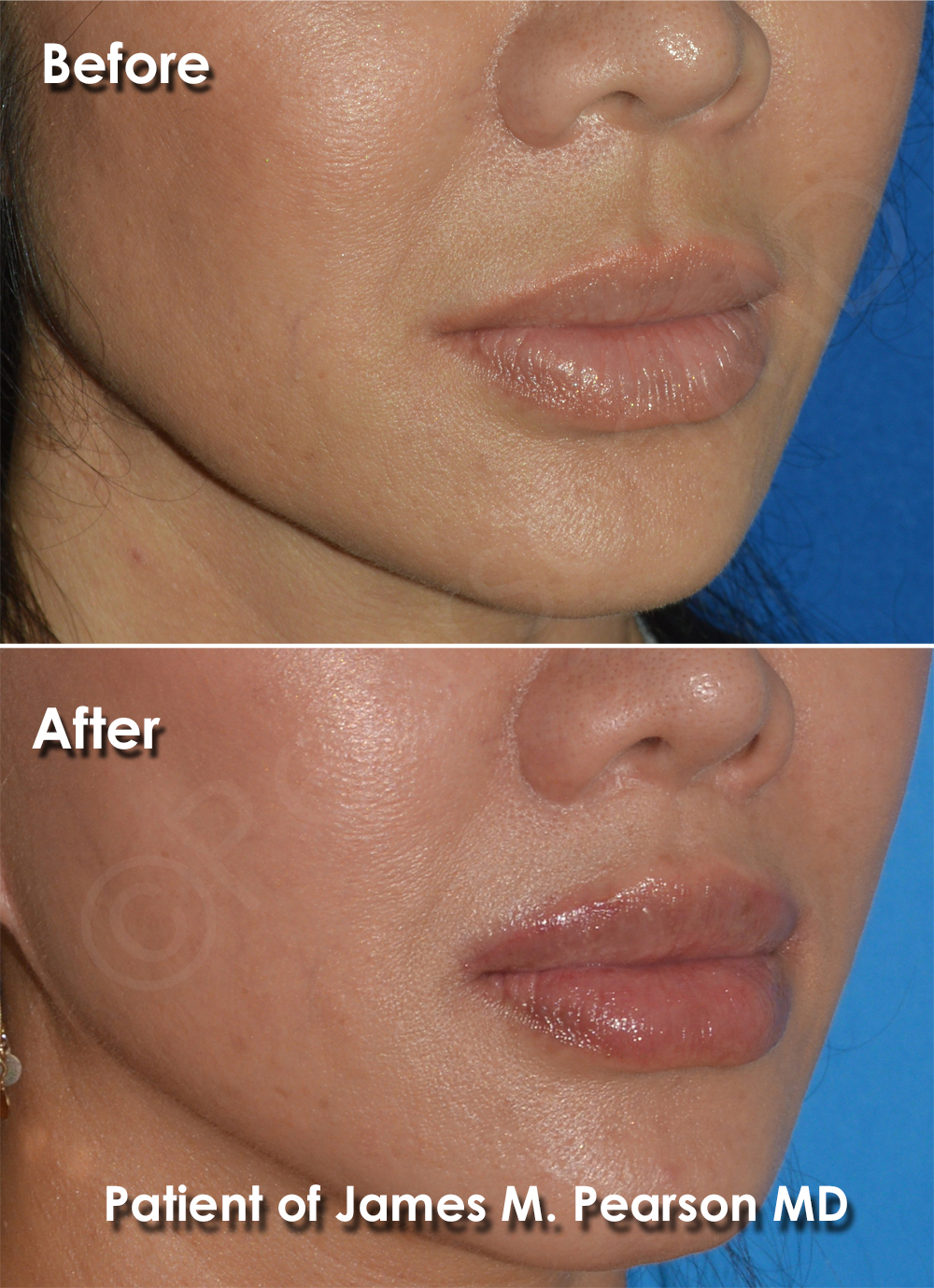 Pearson Cosmetic Surgery
