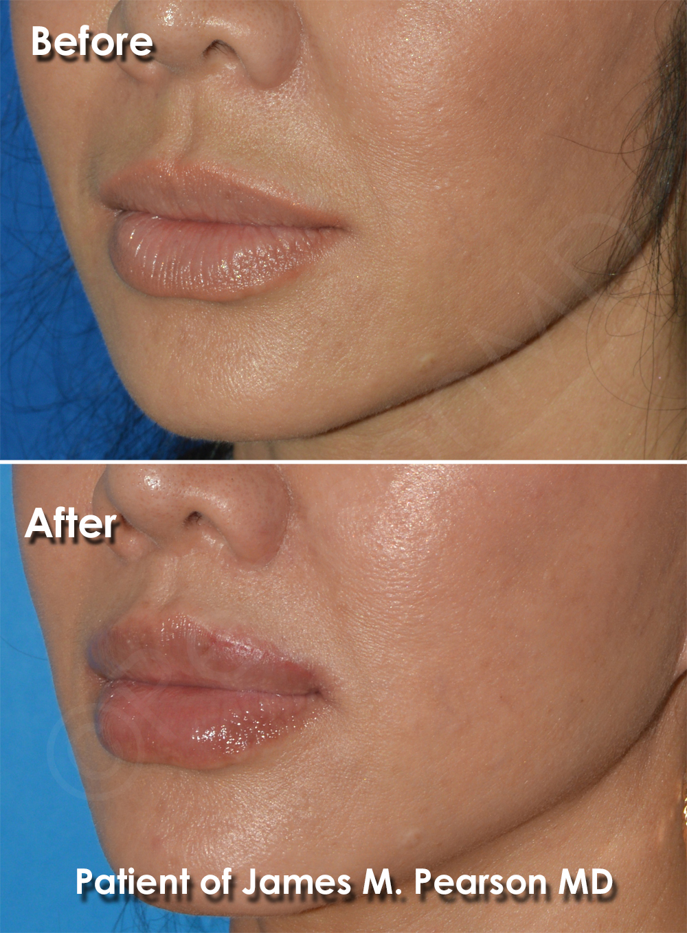 Pearson Plastic Surgery