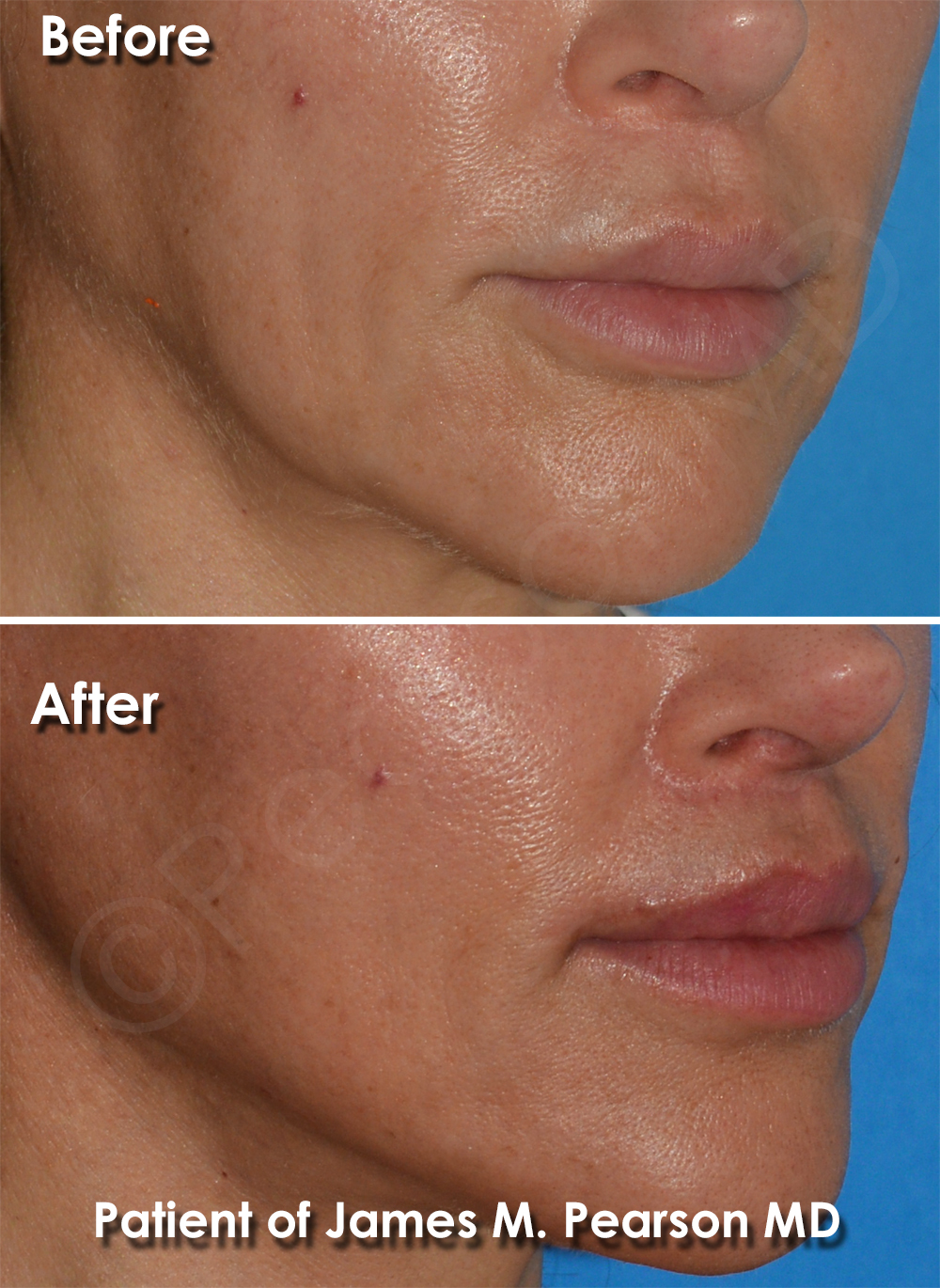 Pearson Plastic Surgery