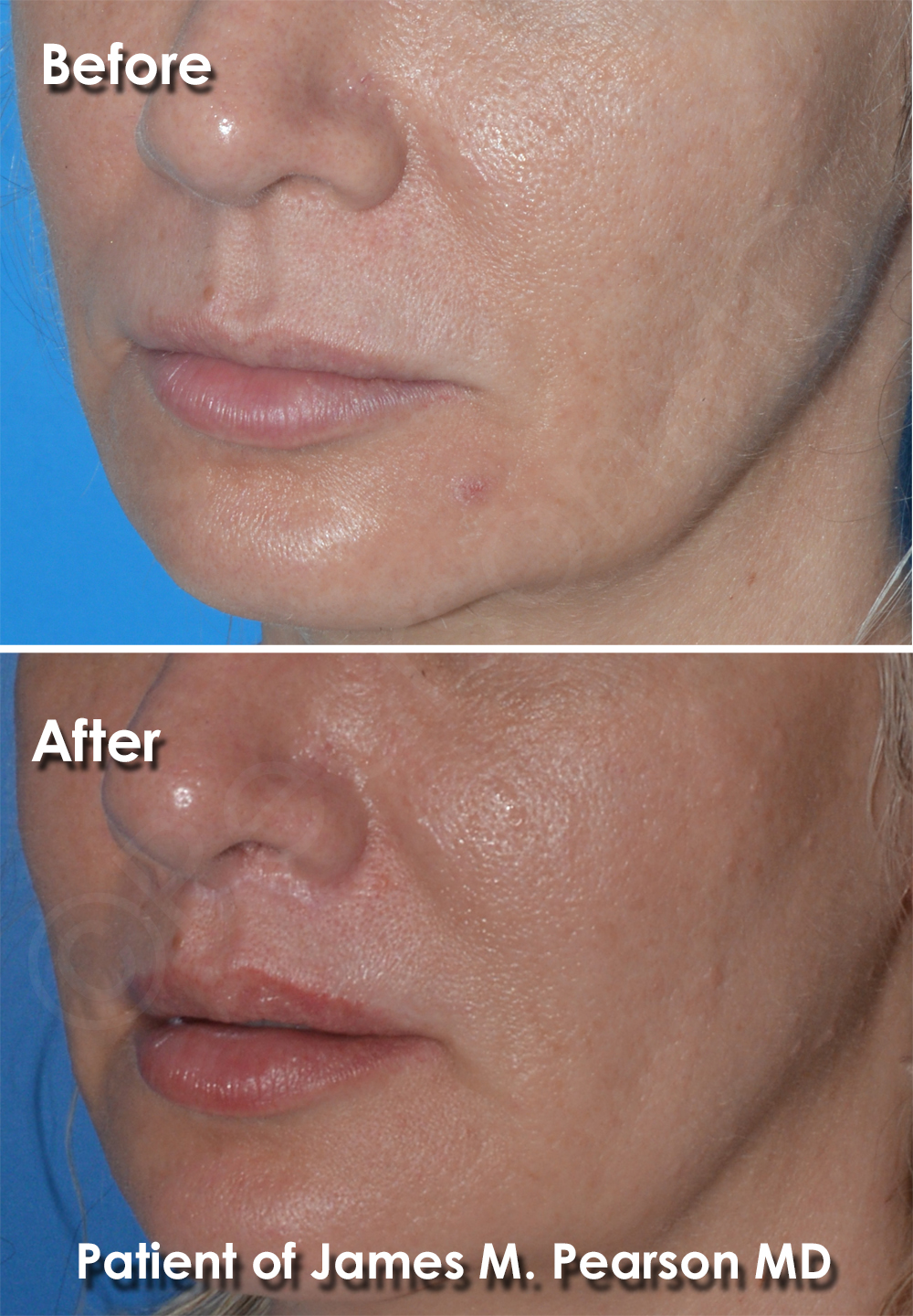 Dr. Pearson Facial Plastic Surgeon