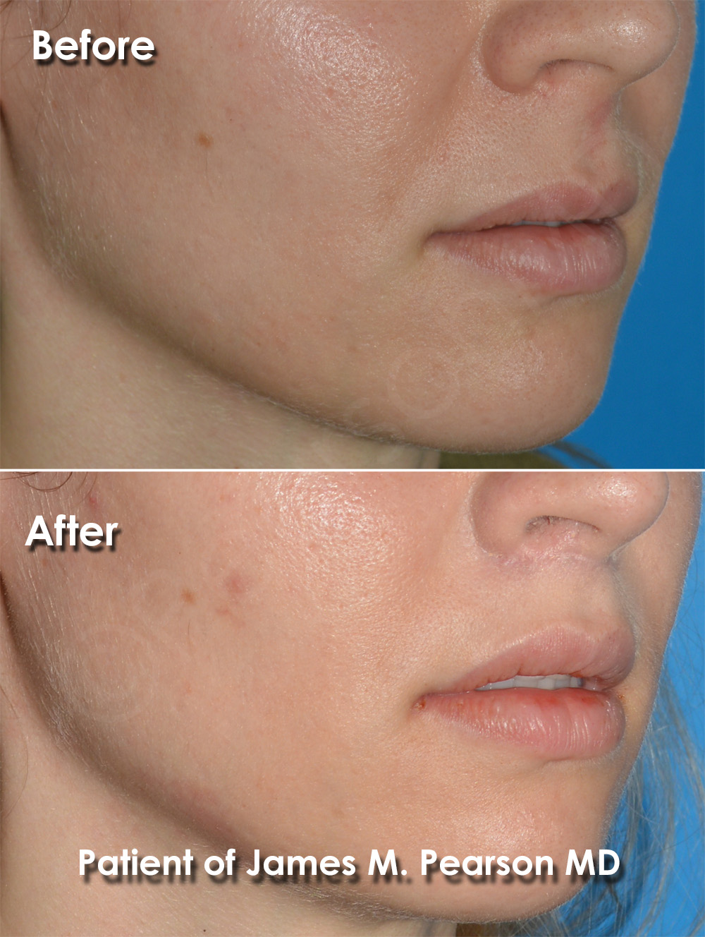 Pearson Plastic Surgery