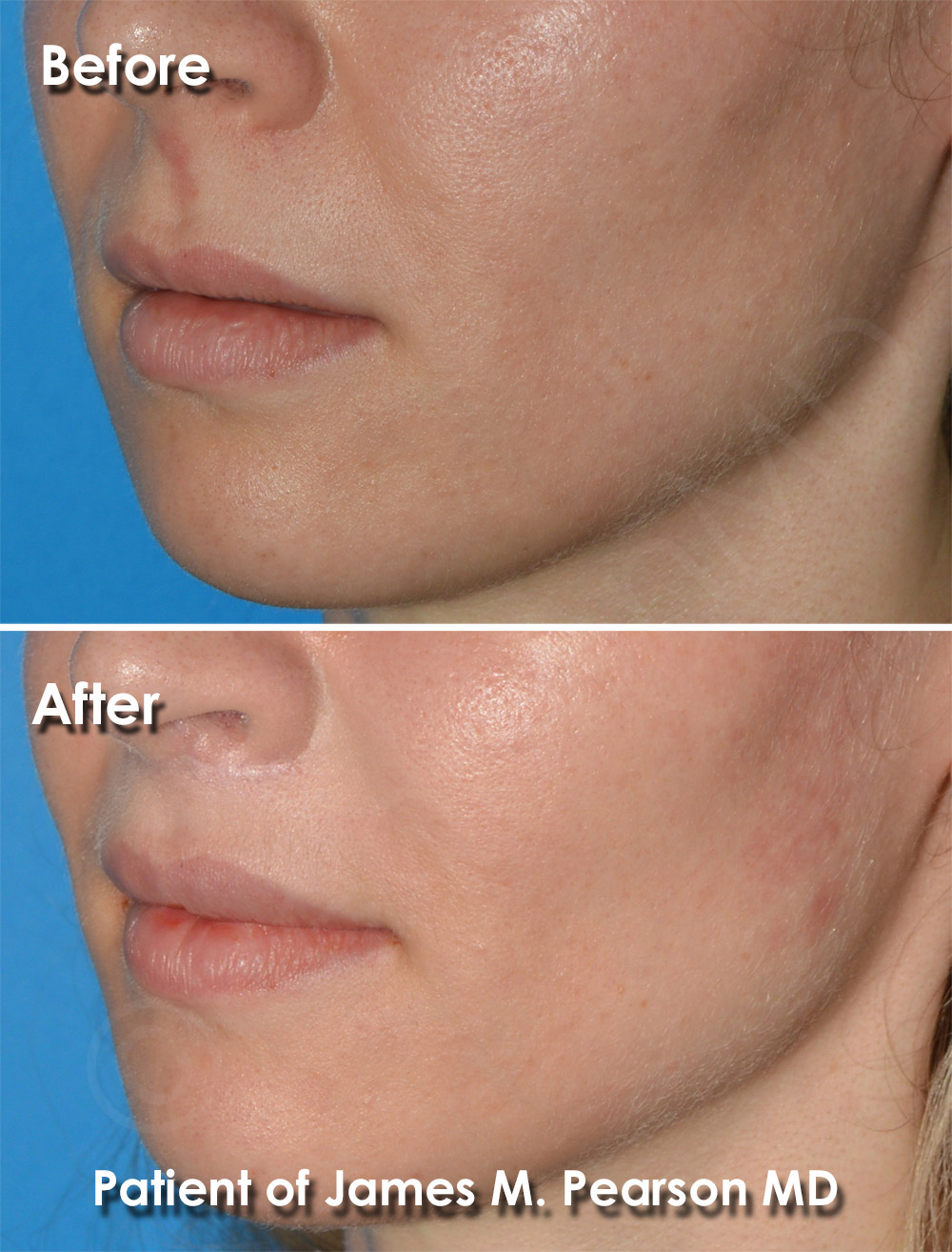 Dr. Pearson Plastic Surgery