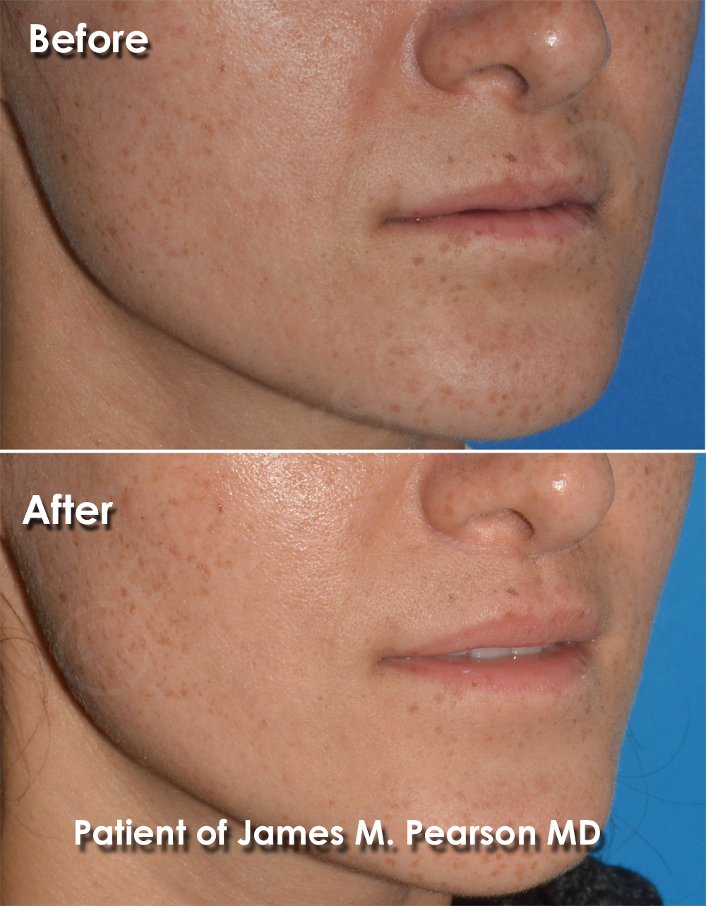 Pearson Plastic Surgery