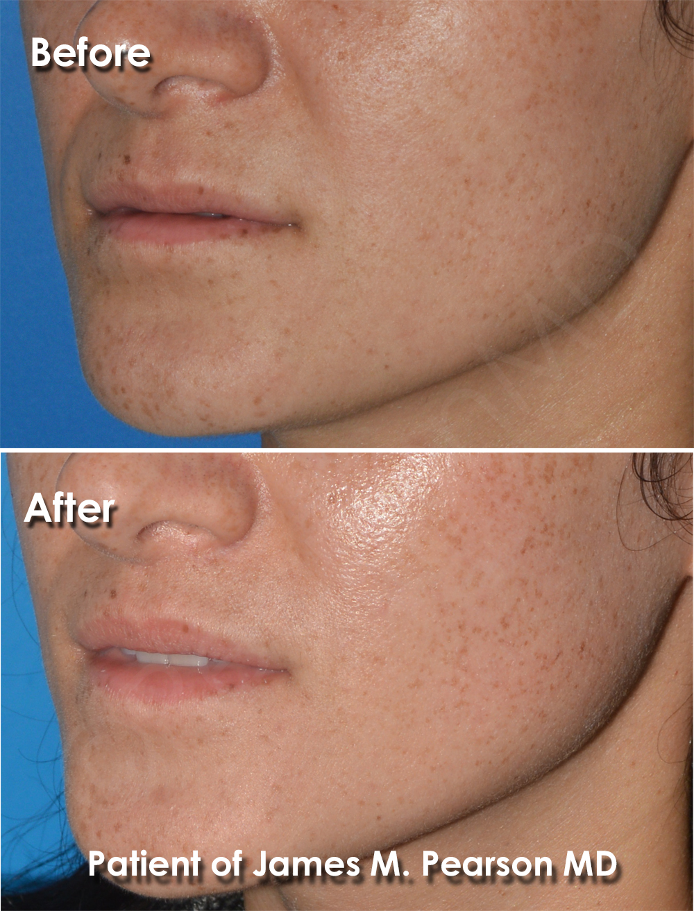 Dr. Pearson Facial Plastic Surgeon