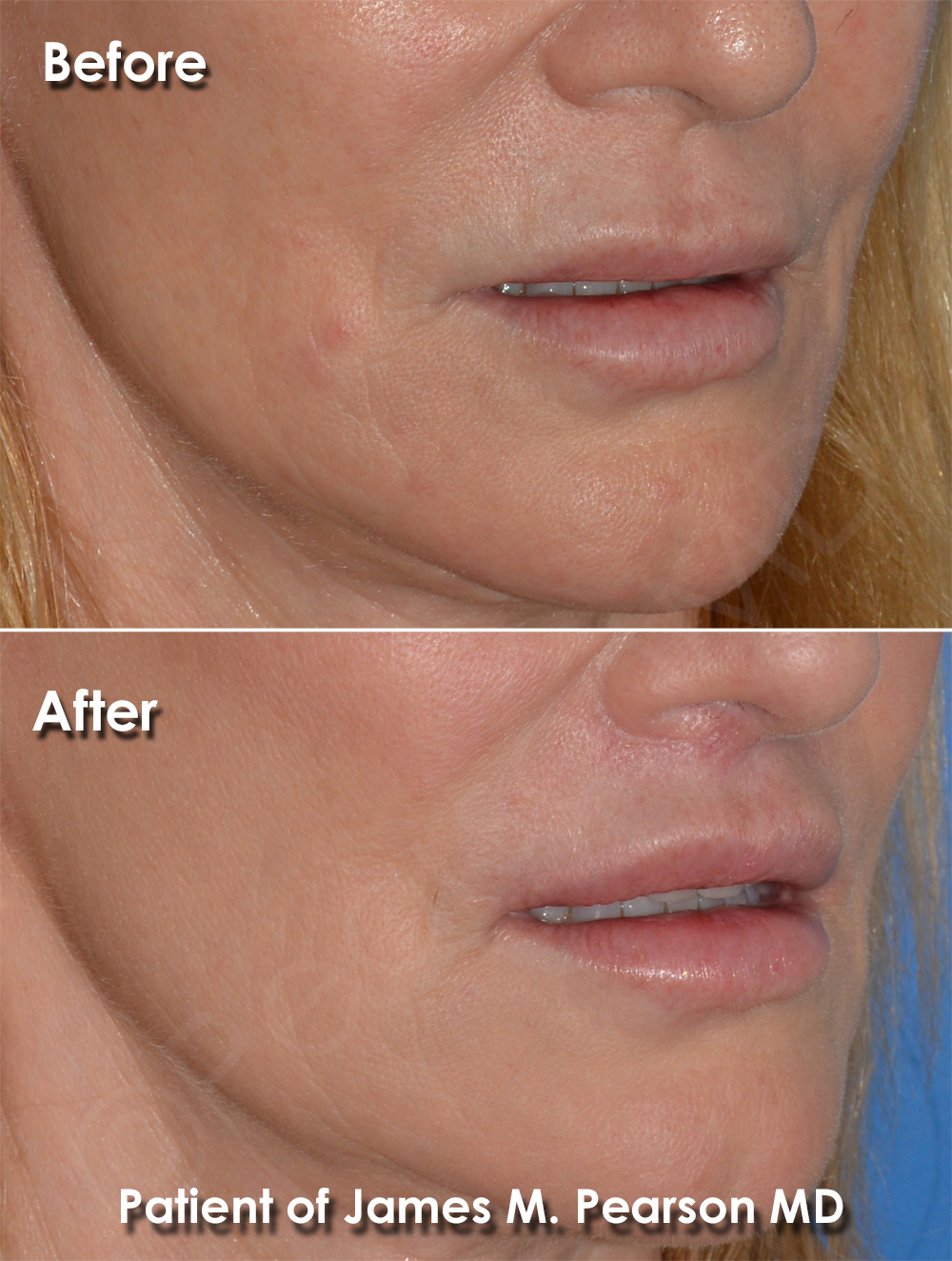 Pearson Plastic Surgery