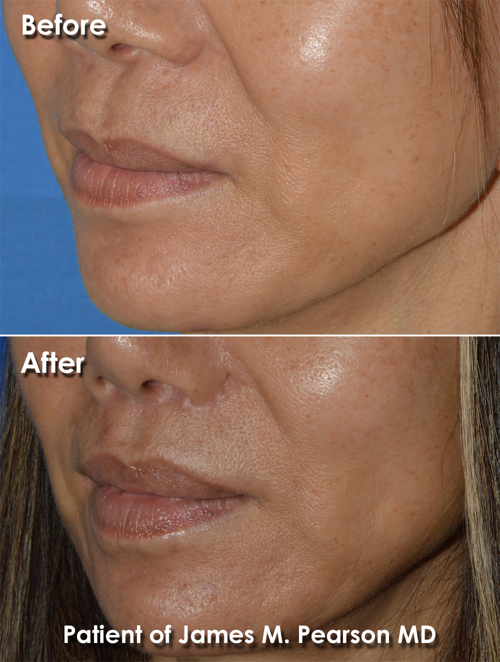 Pearson Plastic Surgery