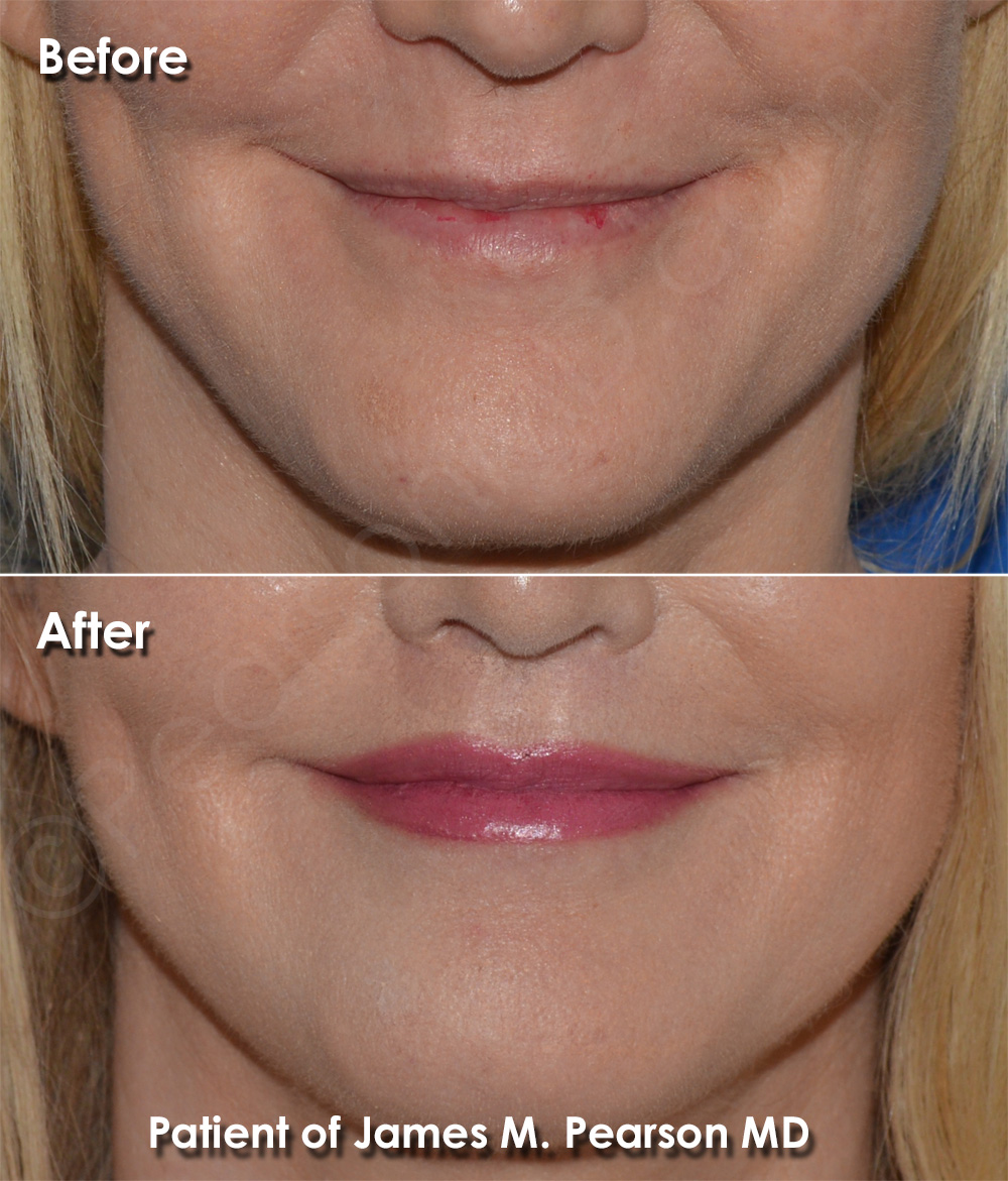 Pearson Plastic Surgery