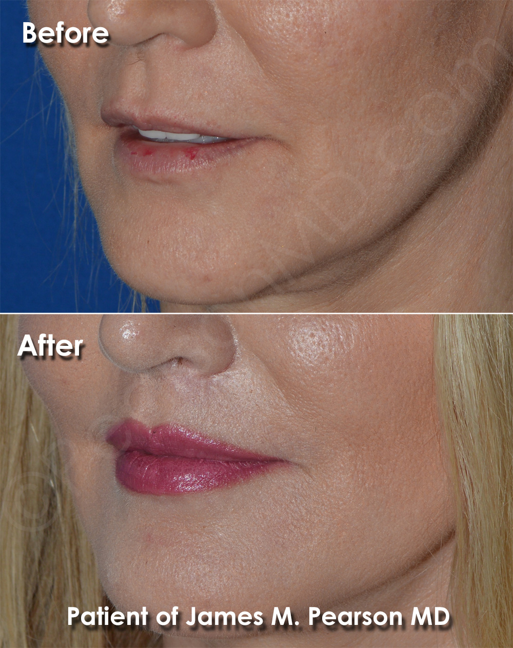 Pearson Cosmetic Surgery
