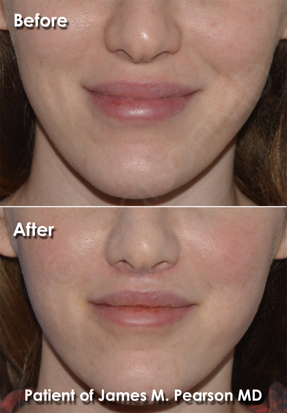 Pearson Plastic Surgery