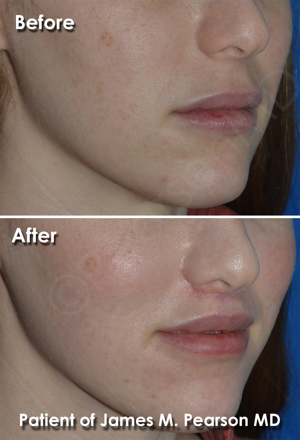 Pearson Cosmetic Surgery
