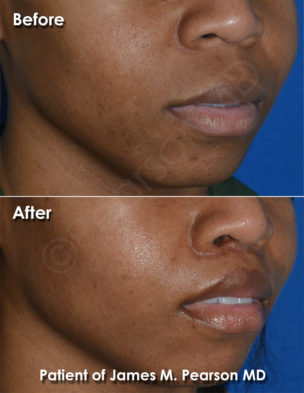 Pearson Plastic Surgery