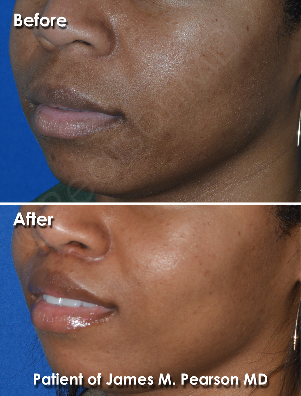 Pearson Cosmetic Surgery
