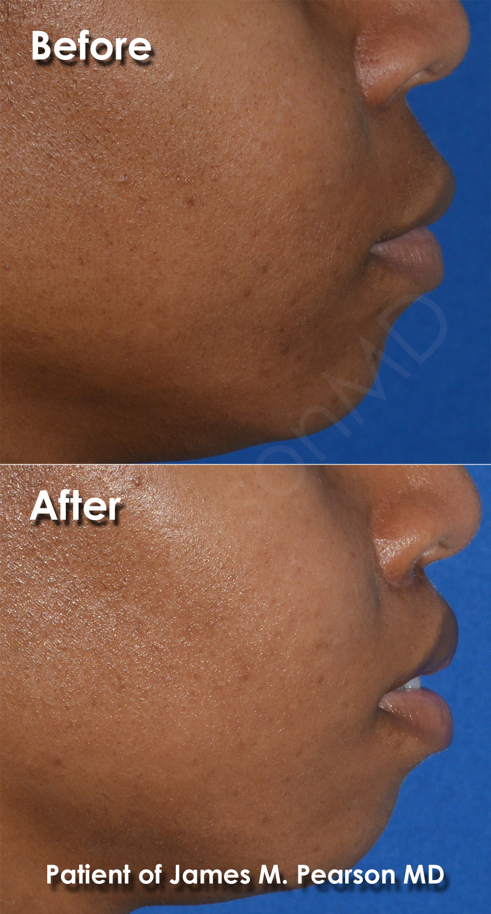 Pearson Plastic Surgery