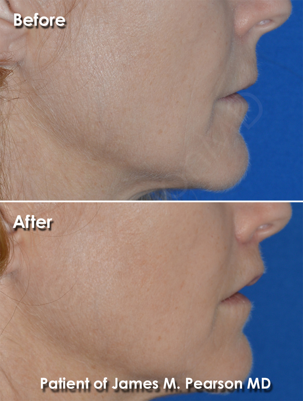 Pearson Plastic Surgery