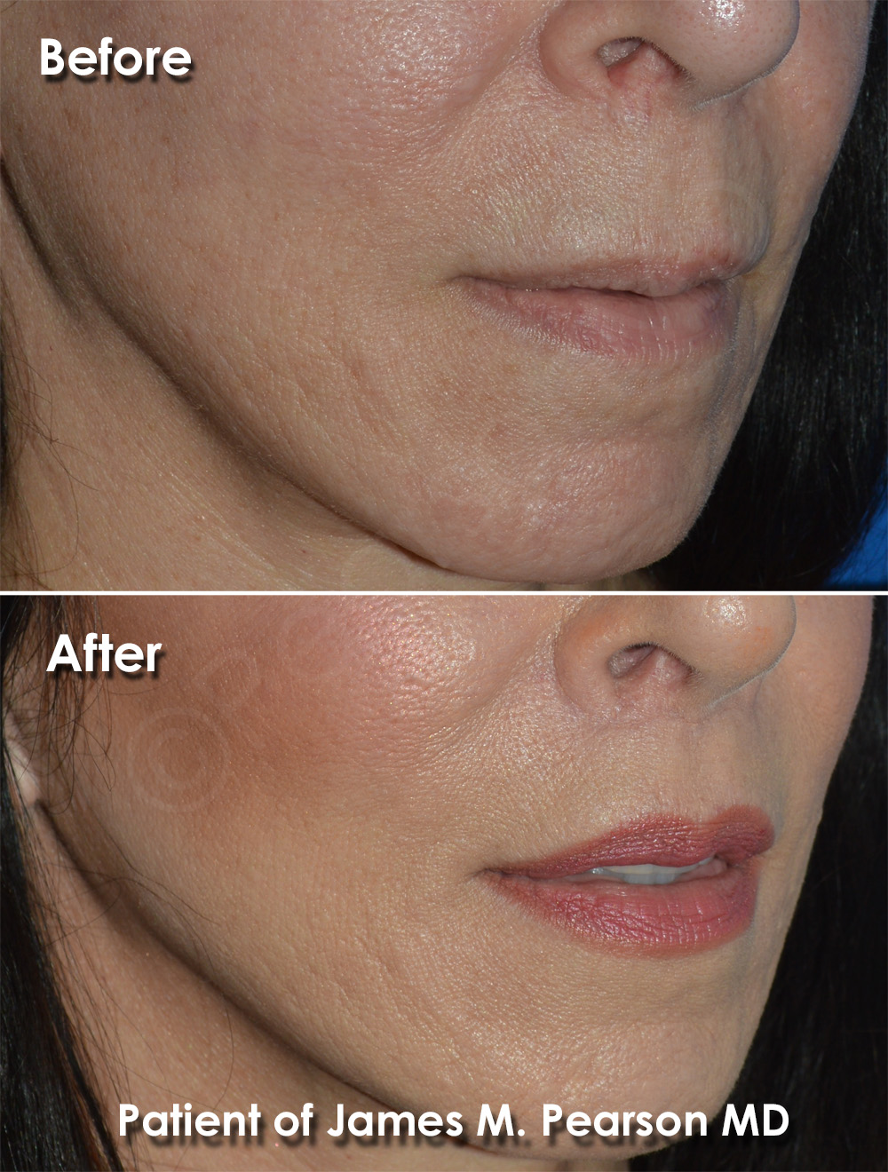 Dr. Pearson Plastic Surgery