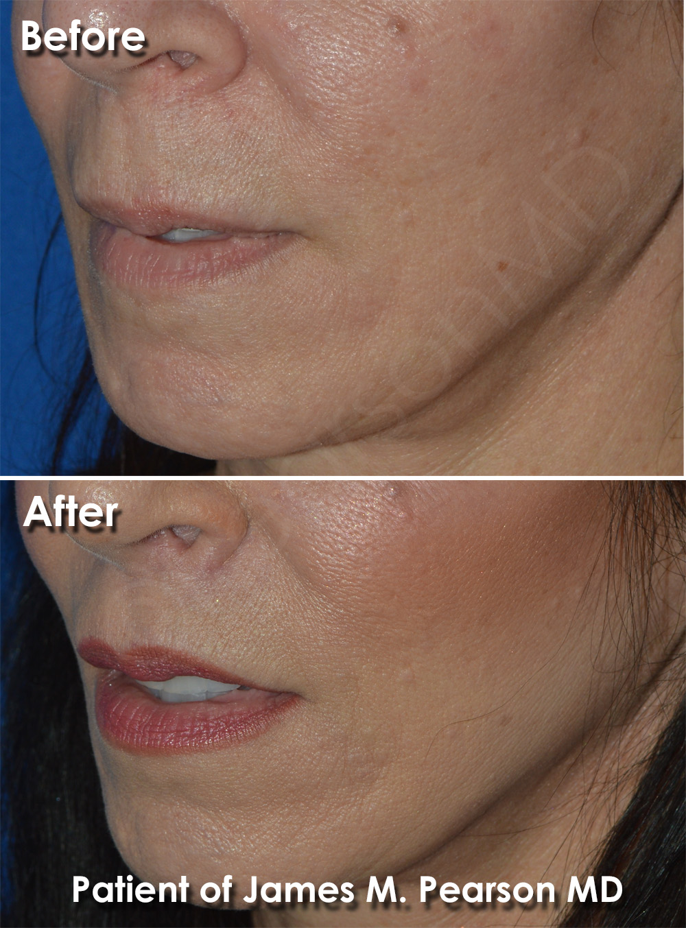 Pearson Cosmetic Surgery