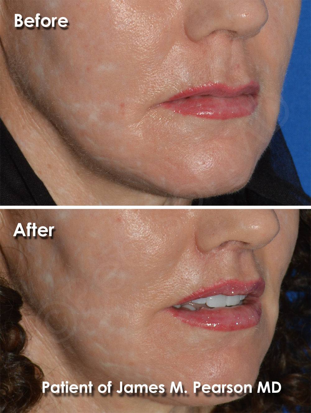 Pearson Cosmetic Surgery