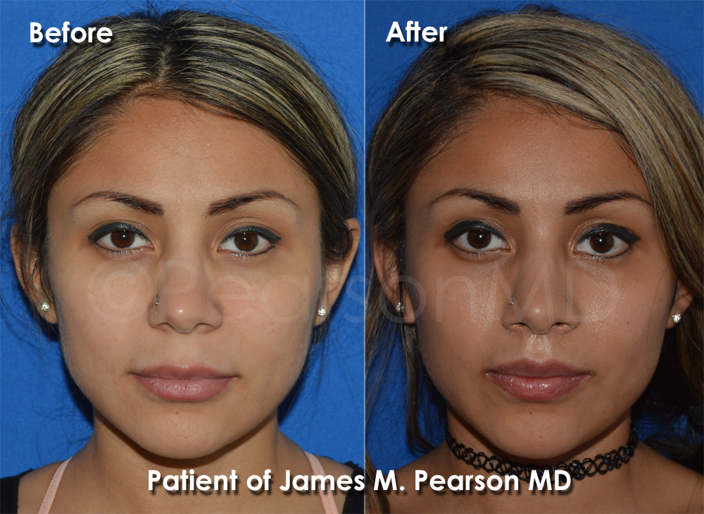 Dr. Pearson Plastic Surgery