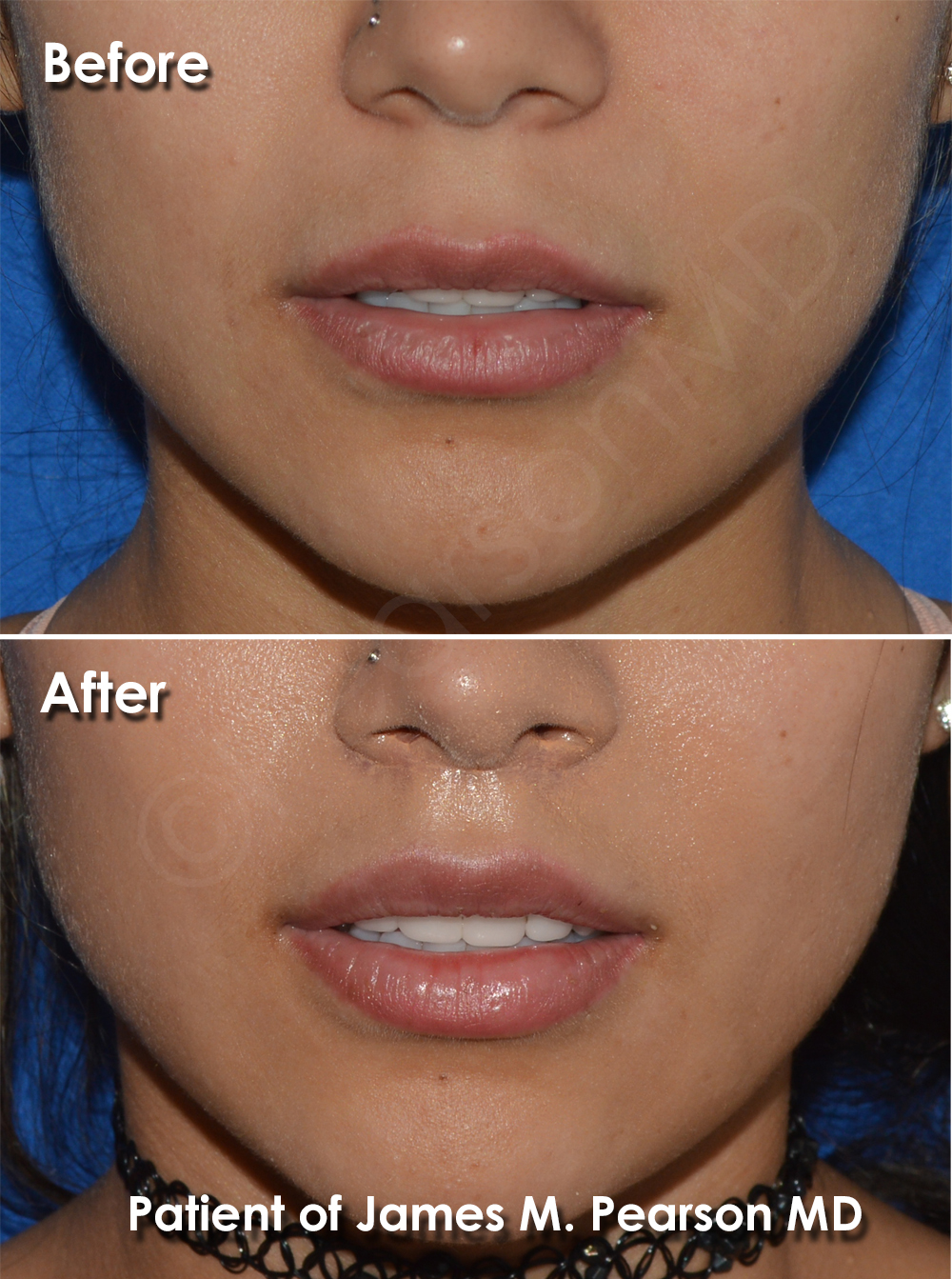 Pearson Cosmetic Surgery