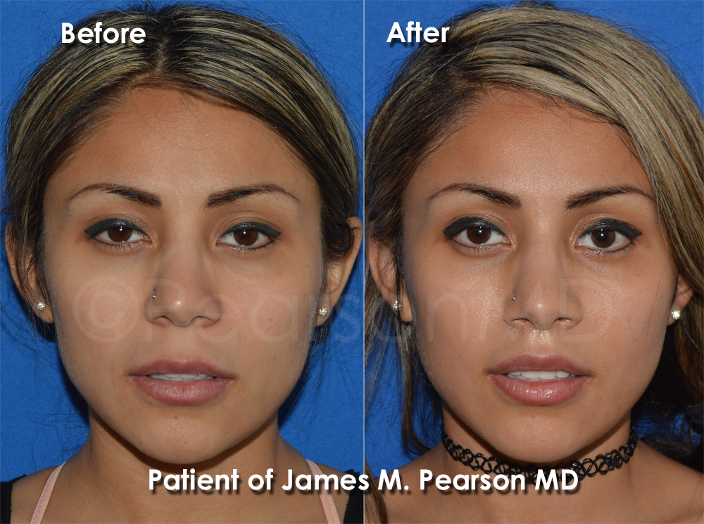 Dr. Pearson Plastic Surgeon