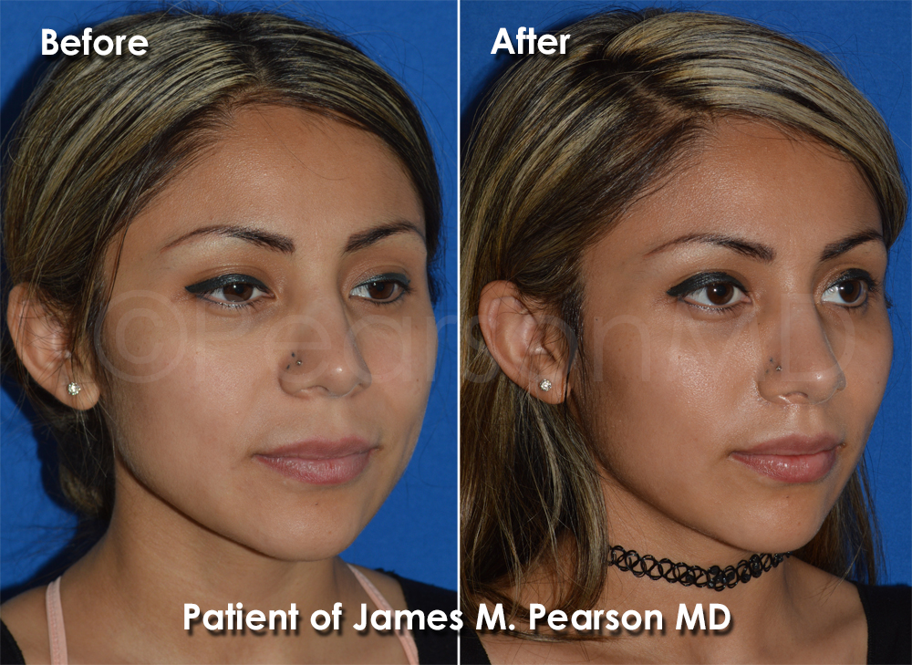 Pearson Plastic Surgery