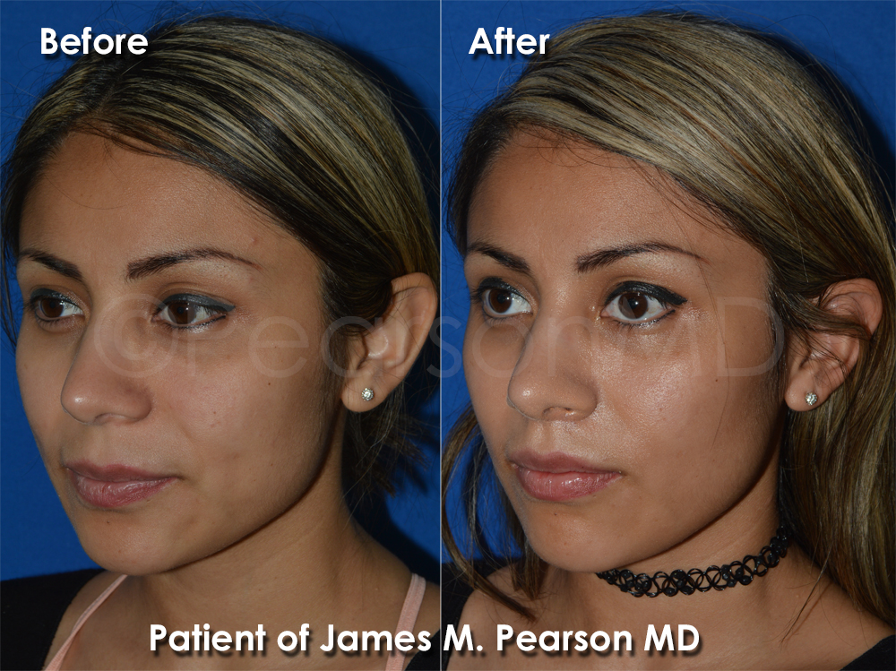 Dr. Pearson Cosmetic Surgeon