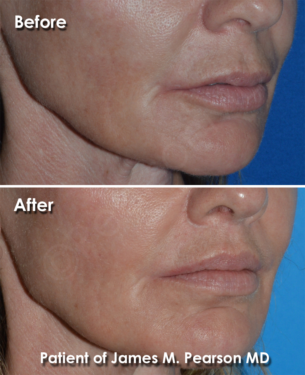 Pearson Plastic Surgery