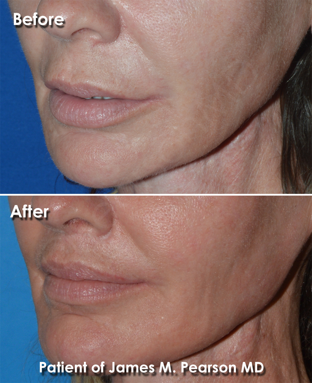 Dr. Pearson Plastic Surgery
