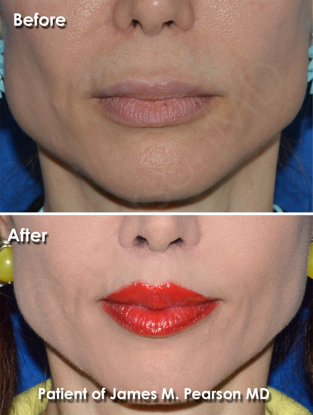 Pearson Cosmetic Surgery