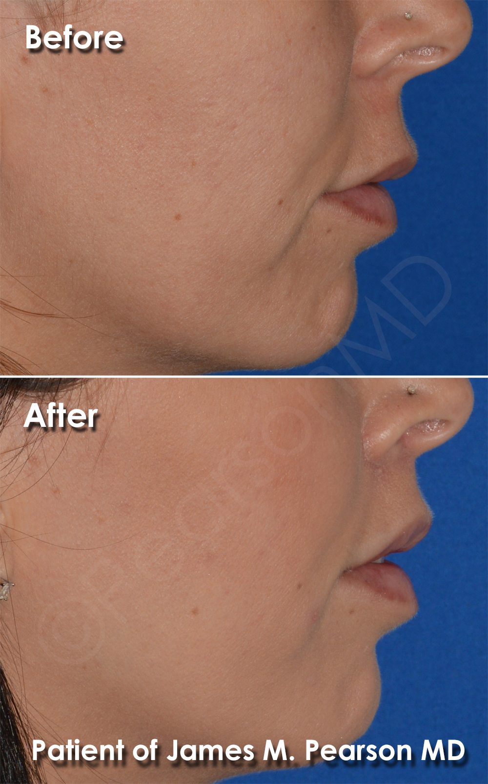 Dr. Pearson Plastic Surgery