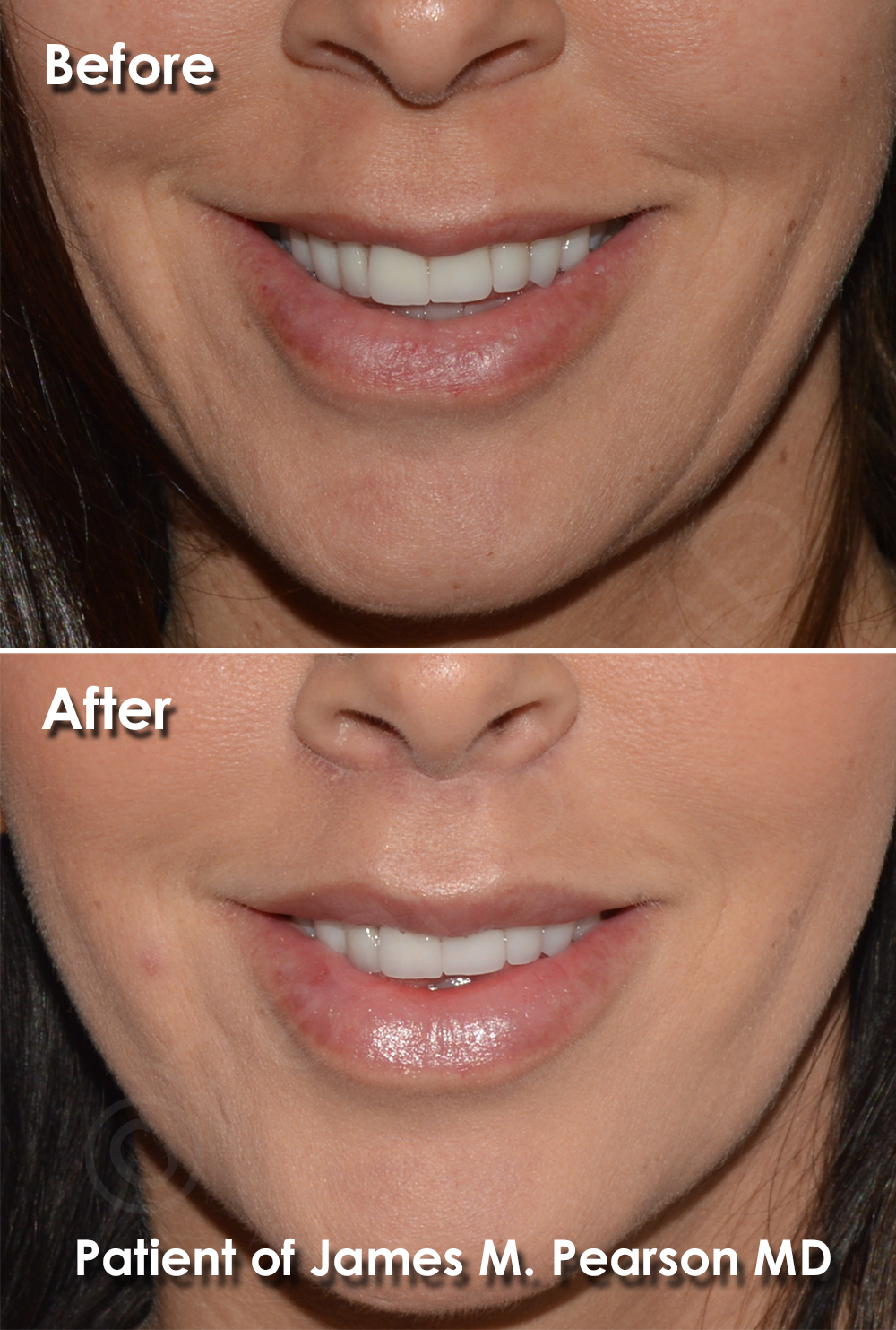Pearson Cosmetic Surgery